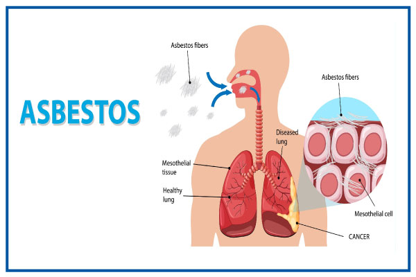 Cons of Asbestos Inhalation in 2024