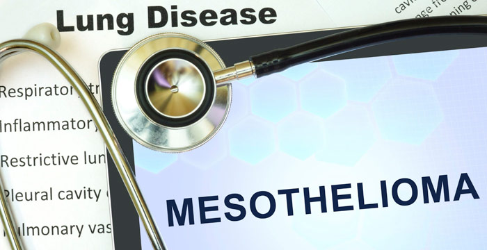 Your Rights and Mesothelioma in 2024